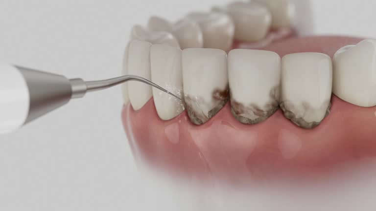 Reliable Teeth Cleaning And Checkup contractor in Kalkaska County County, MI by Dentist Open Now